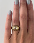 Radial Signet